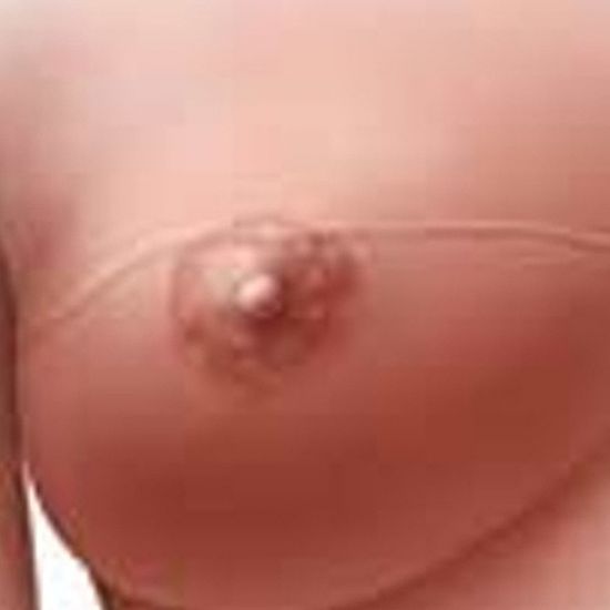 nipple-reconstruction1-zm.jpg